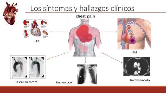 La enfermedad la osteocondrosis del departamento de pecho