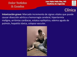 Juan Pablo Peña Diaz, MDMedicina de UrgenciasDolor Torácico& CocaínaClínicaIntoxicación grave: Marcado incremento de signos vitales que puede causar disección aórtica o hemorragia cerebral, hipertermia maligna, arritmias cardiacas, estatus epiléptico, edema agudo de pulmón, hepatitis tóxica, colapso vascular.