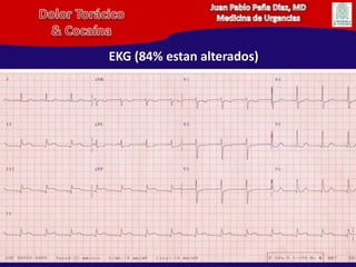 Juan Pablo Peña Diaz, MDMedicina de UrgenciasDolor Torácico& CocaínaEKG (84% estan alterados)