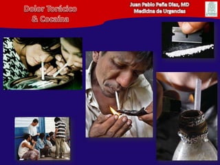 Juan Pablo Peña Diaz, MDMedicina de UrgenciasDolor Torácico& Cocaína