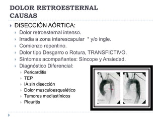 DOLOR RETROESTERNAL
CAUSAS
   DISECCIÓN AÓRTICA:
       Dolor retroesternal intenso.
       Irradia a zona interescapular * y/o ingle.
       Comienzo repentino.
       Dolor tipo Desgarro o Rotura, TRANSFICTIVO.
       Síntomas acompañantes: Síncope y Ansiedad.
       Diagnóstico Diferencial:
           Pericarditis
           TEP
           IA sin disección
           Dolor musculoesquelético
           Tumores mediastínicos
           Pleuritis
 