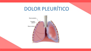 DOLOR PLEURÍTICO
 