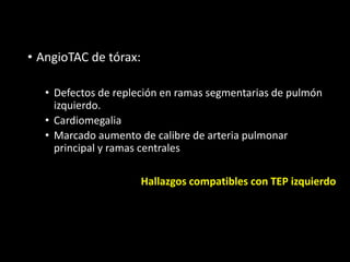 • AngioTAC de tórax:
• Defectos de repleción en ramas segmentarias de pulmón
izquierdo.
• Cardiomegalia
• Marcado aumento de calibre de arteria pulmonar
principal y ramas centrales
Hallazgos compatibles con TEP izquierdo
 