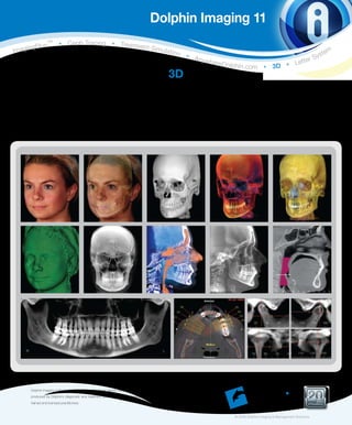 Dolphin Imaging 11
               s
                 TM
                          • Ceph Tracing • Treatmen
      ngPlu                                         t
Imagi                                                                                       Simula
                                                                                                          tion                                                                                    tem
                                                                                                                                                                       s
                                                                                                                     • A
                                                                                                                         nyw                                      r Sy
                                                                                                                               h e re D o
                                                                                                                                          lphin.com • 3D • L ette

                                                                                                         3D
                                            The Dolphin 3D software module is a powerful tool that makes processing 3D
                                            data extremely easy, enabling dental specialists from a wide variety of disciplines
                                            to accurately diagnose and plan treatment. Dolphin 3D allows visualization and
                                            analysis of craniofacial anatomy from data produced by cone beam computed
                                            tomography (CBCT), MRI, medical CT and 3D facial camera systems.




      Dolphin Imaging software is designed specifically for dental clinicians and trained assisting staff. Results
      produced by Dolphin’s diagnostic and treatment planning tools are dependent on the interpretation of
                                                                                                                                                                                           Ye a r s
      trained and licensed practitioners.                                                                                                                                           of Excellence




                                                                                                                                        © 2009 Dolphin Imaging & Management Solutions
 
