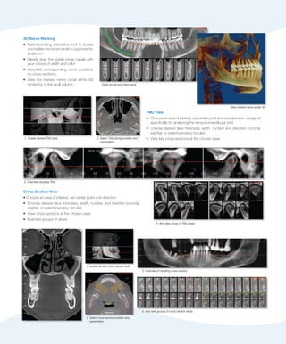 image intensifier dolphin imaging 11.7 image intensifier dolphin imaging 11.7