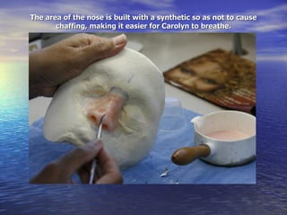 The area of the nose is built with a synthetic so as not to cause chaffing, making it easier for Carolyn to breathe. 