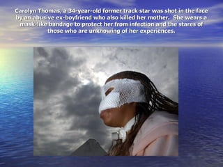 Carolyn Thomas, a 34-year-old former track star was shot in the face by an abusive ex-boyfriend who also killed her mother.  She wears a mask-like bandage to protect her from infection and the stares of those who are unknowing of her experiences. 