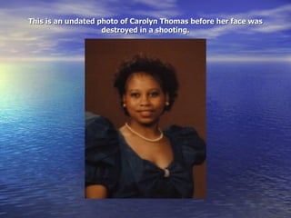 This is an undated photo of Carolyn Thomas before her face was destroyed in a shooting. 