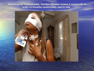 Adjusting her trachea tube, Carolyn Thomas cleans it constantly in order to breathe comfortably and to talk.  