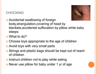 CHOCKING
 Accidental swallowing of foreign
body,strangulation,covering of head by
blankets,accidental suffocation by pillow while baby
sleeps
 What to do?
 Choose toys appropriate to the age of children
 Avoid toys with very small parts
 Strings and plastic bags should be kept out of reach
of children
 Instruct children not to play while eating
 Never use pillow for baby under 1 yr of age
 