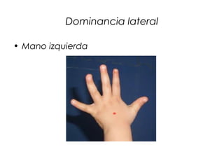 Dominancia lateral

• Mano izquierda
 
