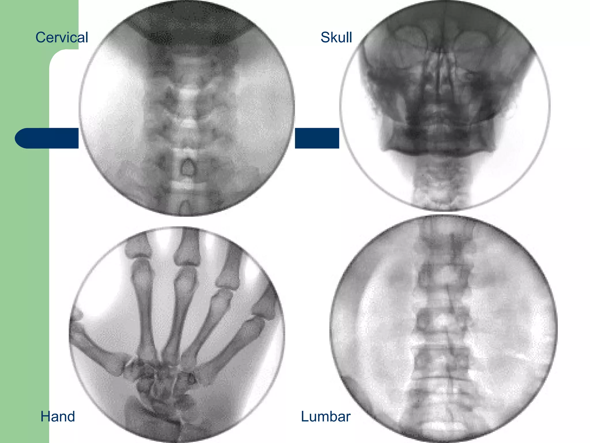 Cervical Hand Lumbar Skull 