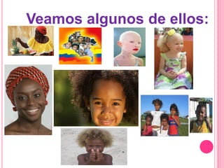 Veamos algunos de ellos:
 