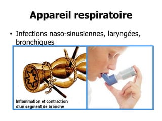 Appareil respiratoire
• Infections naso-sinusiennes, laryngées,
bronchiques

 