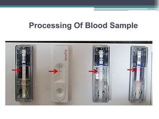 Processing Of Blood Sample
 