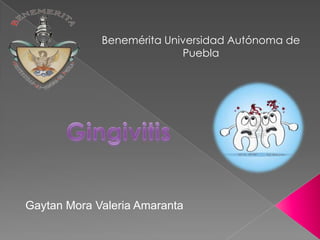 Benemérita Universidad Autónoma de
Puebla

Gaytan Mora Valeria Amaranta

 