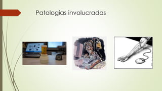 Patologías involucradas
 