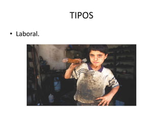 TIPOS
• Laboral.
 