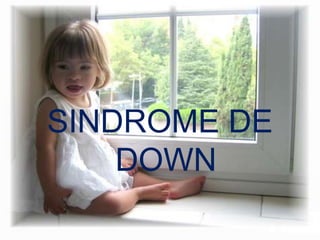 SINDROME DE DOWN 