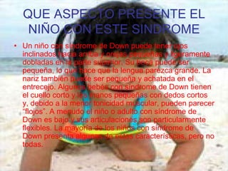 QUE ASPECTO PRESENTE EL NIÑO CON ESTE SINDROMEUn niño con síndrome de Down puede tener ojos inclinados hacia arriba y orejas pequeñas y ligeramente dobladas en la parte superior. Su boca puede ser pequeña, lo que hace que la lengua parezca grande. La nariz también puede ser pequeña y achatada en el entrecejo. Algunos bebés con síndrome de Down tienen el cuello corto y las manos pequeñas con dedos cortos y, debido a la menor tonicidad muscular, pueden parecer “flojos”. A menudo el niño o adulto con síndrome de Down es bajo y sus articulaciones son particularmente flexibles. La mayoría de los niños con síndrome de Down presenta algunas de estas características, pero no todas. 