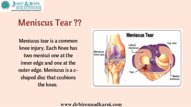 Meniscus Tear Treatment In Delhi Knee Cartilage Injury