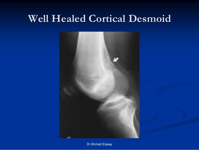 Don T Touch Lesions New Version Dr Ahmed Esawy