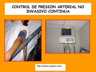 CONTROL DE PRESION ARTERIAL NO
     INVASIVO CONTINUA




          http://www.uciperu.com
 