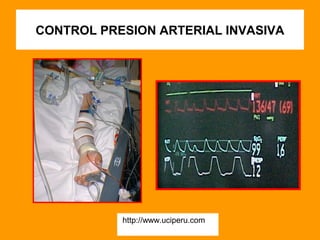 CONTROL PRESION ARTERIAL INVASIVA




           http://www.uciperu.com
 