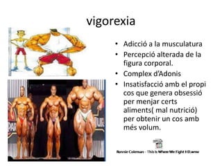 vigorexia
• Adicció a la musculatura
• Percepció alterada de la
figura corporal.
• Complex d’Adonis
• Insatisfacció amb el propi
cos que genera obsessió
per menjar certs
aliments( mal nutrició)
per obtenir un cos amb
més volum.
 