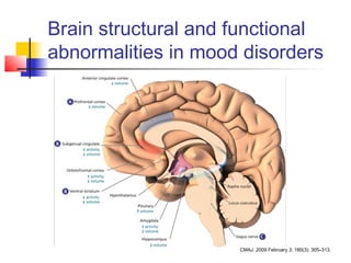 Brain structural and functional
abnormalities in mood disorders
CMAJ. 2009 February 3; 180(3): 305–313.
 