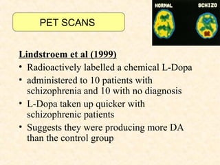 PET SCANS


Lindstroem et al (1999)
• Radioactively labelled a chemical L-Dopa
• administered to 10 patients with
  schizophrenia and 10 with no diagnosis
• L-Dopa taken up quicker with
  schizophrenic patients
• Suggests they were producing more DA
  than the control group
 