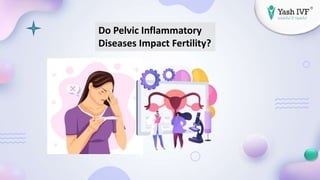 Do Pelvic Inflammatory
Diseases Impact Fertility?
 