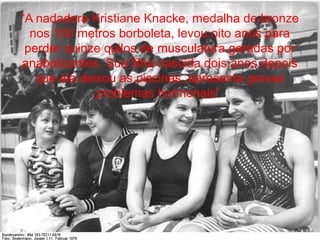 “A nadadora Kristiane Knacke, medalha de bronze
nos 100 metros borboleta, levou oito anos para
perder quinze quilos de musculatura geradas por
anabolizantes. Sua filha nascida dois anos depois
que ela deixou as piscinas, apresenta graves
problemas hormonais”.
 