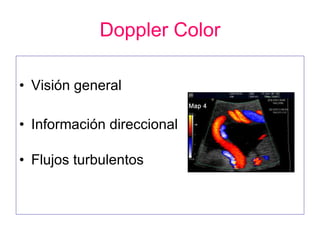 Doppler Color Visión general  Información direccional Flujos turbulentos  
