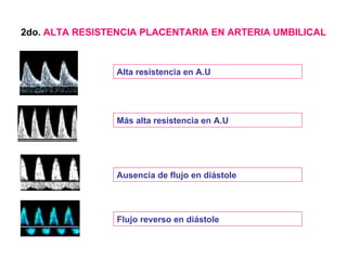 2do.  ALTA RESISTENCIA PLACENTARIA EN ARTERIA UMBILICAL Alta resistencia en A.U  Más alta resistencia en A.U  Ausencia de flujo en diástole Flujo reverso en diástole  