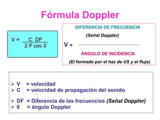 Fórmula Doppler <ul><li>V  = velocidad </li></ul><ul><li>C  = velocidad de propagación   del sonido    </li></ul><ul><li>D...