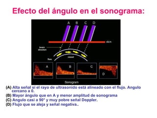 Efecto del ángulo en el sonograma: <ul><li>(A)   Alta señal si el rayo de ultrasonido está alineado con el flujo. Angulo c...