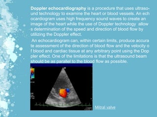 Doppler echocardiography is a procedure that uses ultraso-
und technology to examine the heart or blood vessels. An ech
ocardiogram uses high frequency sound waves to create an
image of the heart while the use of Doppler technology allow
s determination of the speed and direction of blood flow by
utilizing the Doppler effect.
An echocardiogram can, within certain limits, produce accura
te assessment of the direction of blood flow and the velocity o
f blood and cardiac tissue at any arbitrary point using the Dop
pler effect. One of the limitations is that the ultrasound beam
should be as parallel to the blood flow as possible.
Mitral valve
 