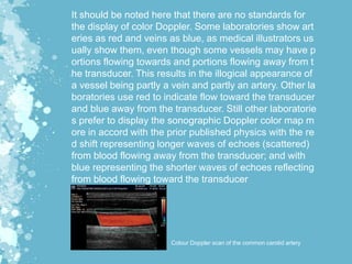 It should be noted here that there are no standards for
the display of color Doppler. Some laboratories show art
eries as red and veins as blue, as medical illustrators us
ually show them, even though some vessels may have p
ortions flowing towards and portions flowing away from t
he transducer. This results in the illogical appearance of
a vessel being partly a vein and partly an artery. Other la
boratories use red to indicate flow toward the transducer
and blue away from the transducer. Still other laboratorie
s prefer to display the sonographic Doppler color map m
ore in accord with the prior published physics with the re
d shift representing longer waves of echoes (scattered)
from blood flowing away from the transducer; and with
blue representing the shorter waves of echoes reflecting
from blood flowing toward the transducer
Colour Doppler scan of the common carotid artery
 