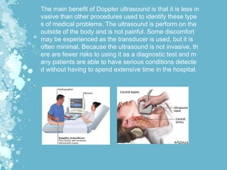 The main benefit of Doppler ultrasound is that it is less in
vasive than other procedures used to identify these type
s of medical problems. The ultrasound is perform on the
outside of the body and is not painful. Some discomfort
may be experienced as the transducer is used, but it is
often minimal. Because the ultrasound is not invasive, th
ere are fewer risks to using it as a diagnostic test and m
any patients are able to have serious conditions detecte
d without having to spend extensive time in the hospital.
 