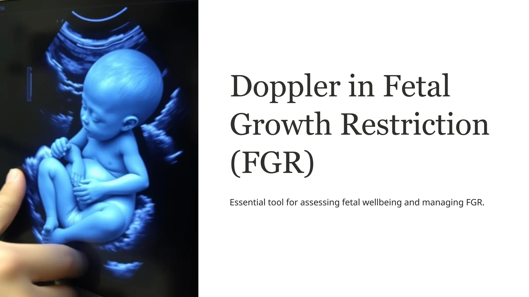 Intrauterine growth restriction: MedlinePlus Medical Encyclopedia