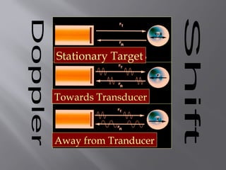Stationary Target
Towards Transducer
Away from Tranducer
 