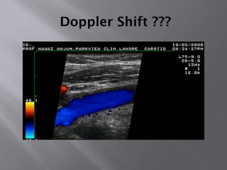 Doppler Shift ???
 