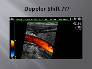 Doppler Shift ???
 