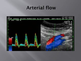 Arterial flow
 