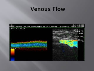 Venous Flow
 