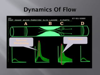 A B C D
Dynamics Of Flow
Spectral
Broadening
Turbulance
 
