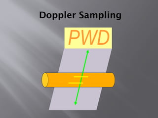 Doppler Sampling
 