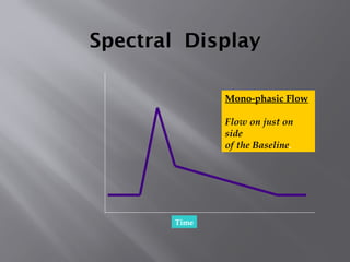 Spectral Display
Time
Mono-phasic Flow
Flow on just on
side
of the Baseline.
 