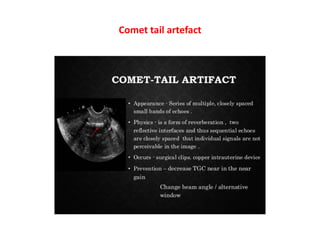 Comet tail artefact
 